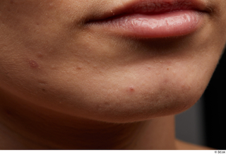 HD Face Skin Kate Jones chin face lips mouth skin…